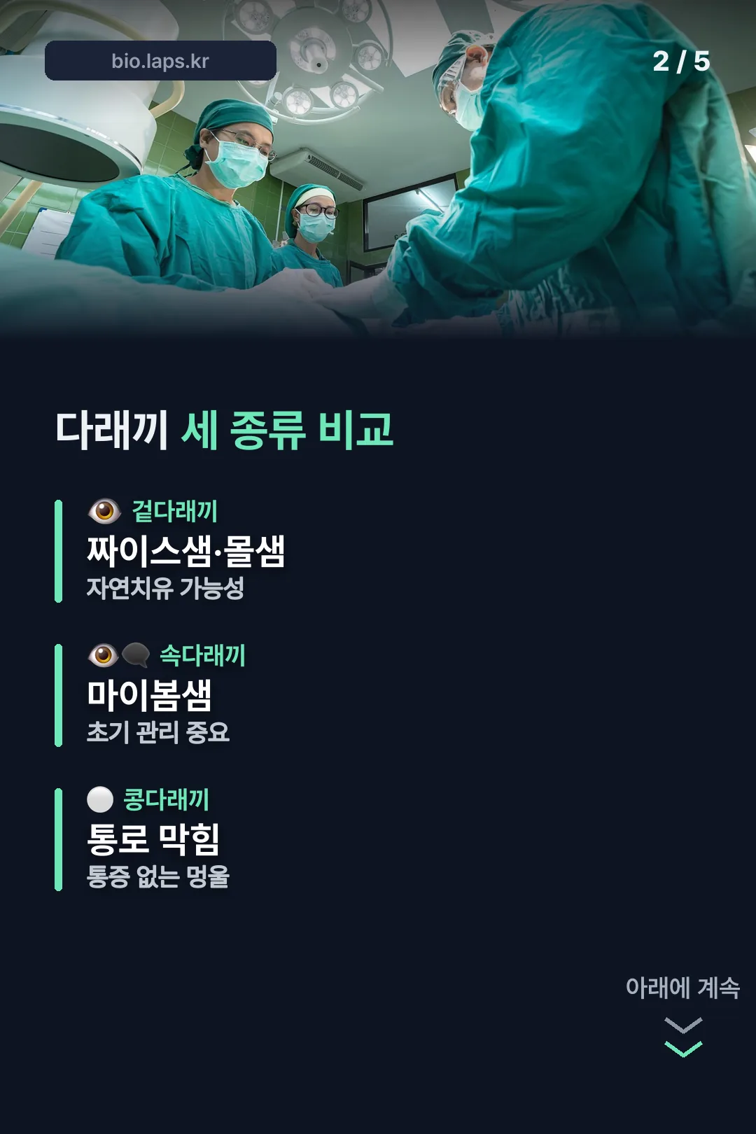 세 종류 비교