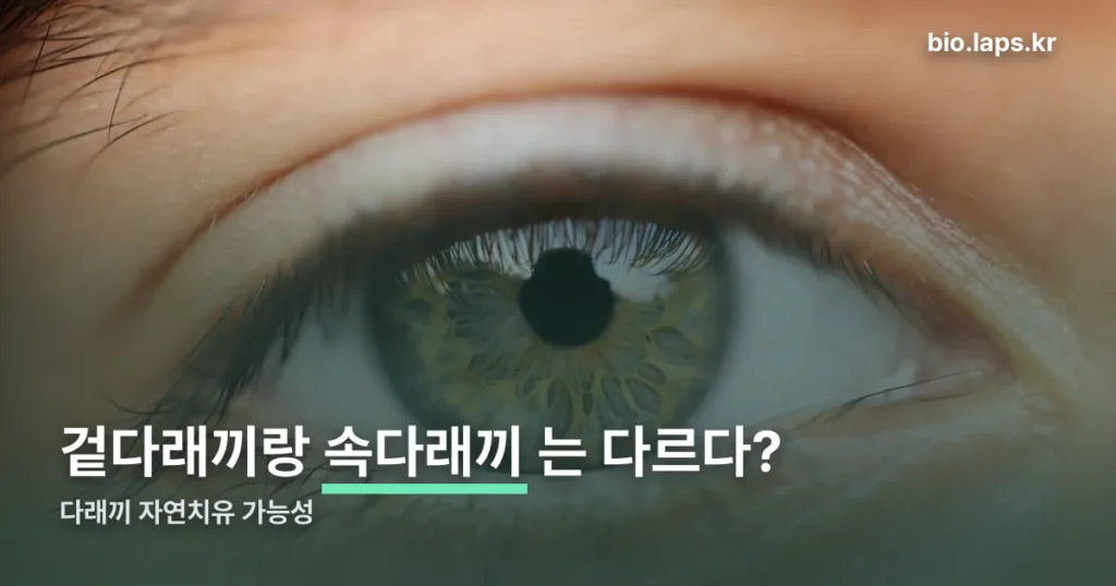 다래끼 자연치유 정리 썸네일